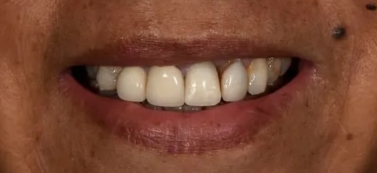 smile gallery image
