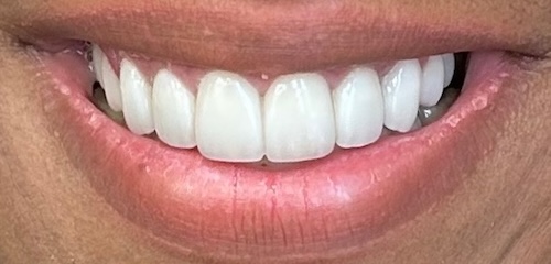 Divana After