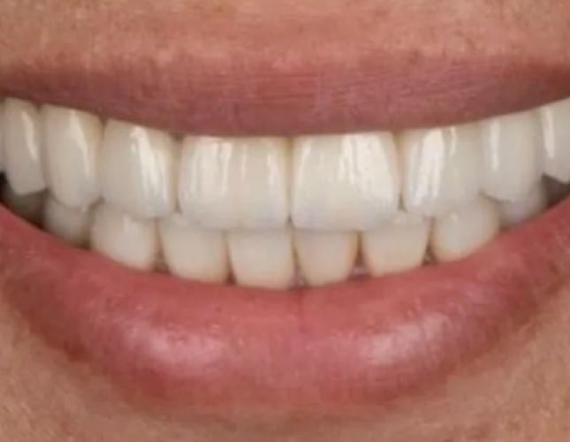 Dr. Lim's Beautiful Work 2 after