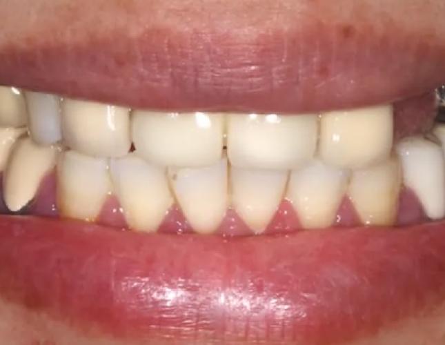 Dr. Lim's Beautiful Work 2 before