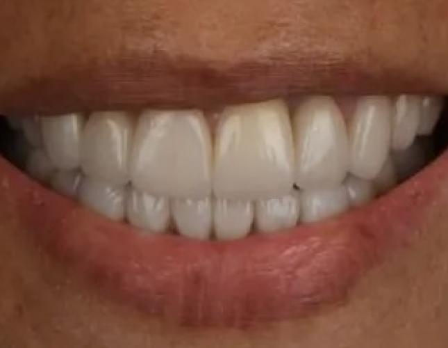 Dr. Lim's Beautiful Work 1 after