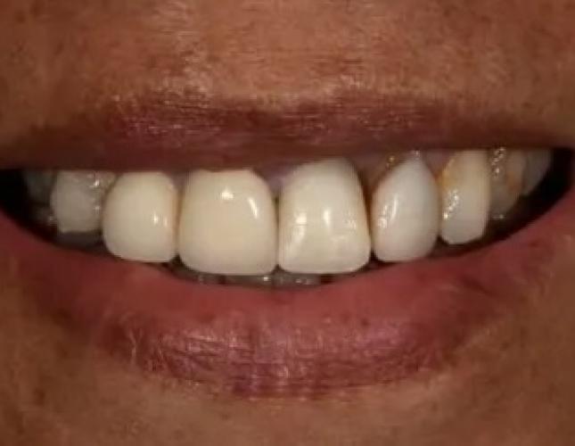 Dr. Lim's Beautiful Work 1 before