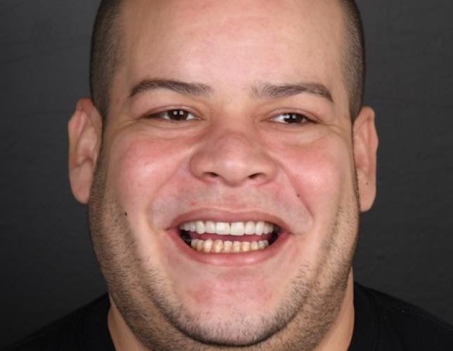 Ricardo full after