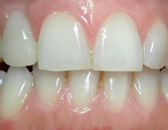 Giannina before