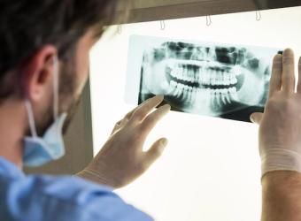 Immediate vs. Delayed Dental Implant Placement