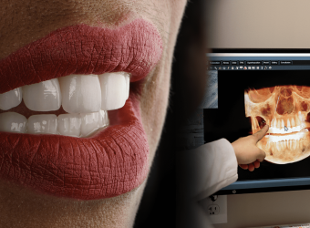 Implants vs. Bridges: What’s the Real Difference?