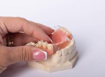 Cost Considerations: Understanding the Financial Aspects of Dental Bridges