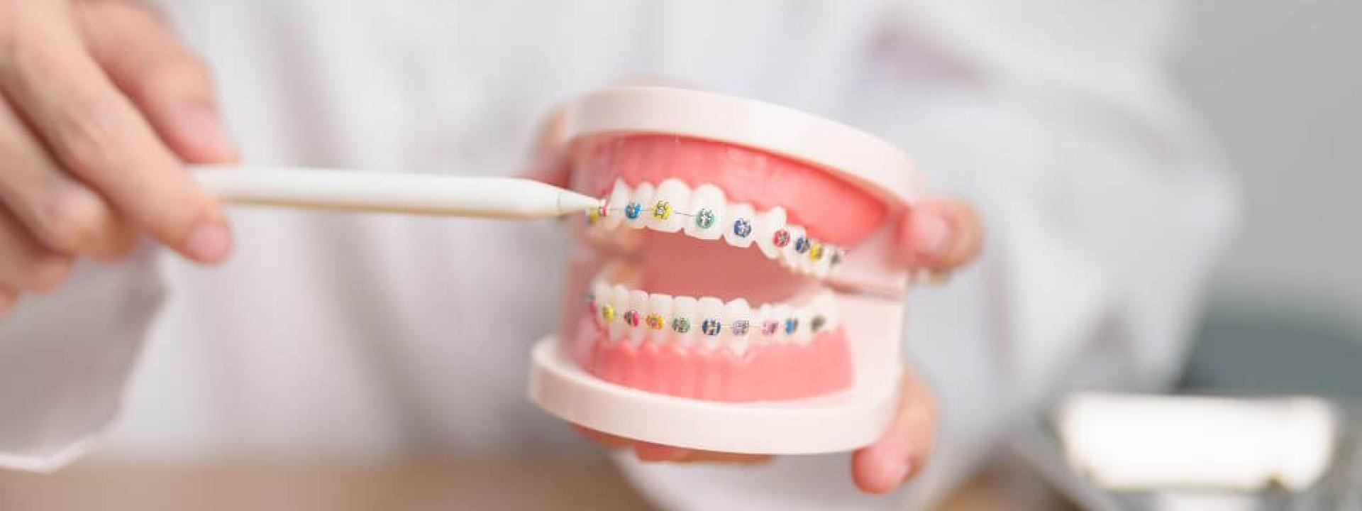 Transform Your Smile: A Comprehensive Look at Orthodontic Care Transform Your Smile: A Comprehensive Look at Orthodontic Care